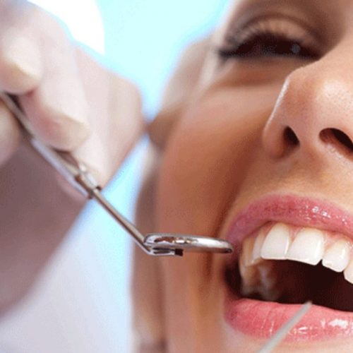 DENTISTERIE PREVENTIVE