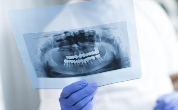 ORAL DİAGNOZ ve RADYOLOJİ ORAL DİAGNOZ ve RADYOLOJİ