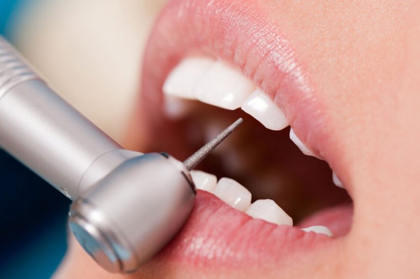 ENDODONTİ (Kanal Tedavisi) ENDODONTİ (Kanal Tedavisi)