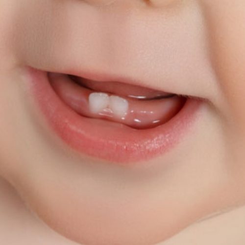 Les dents de lait Traites vous fait